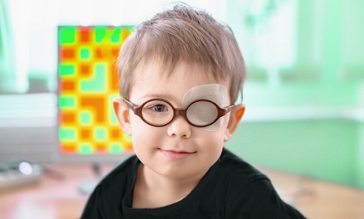 درمان تنبلی چشم کودکان